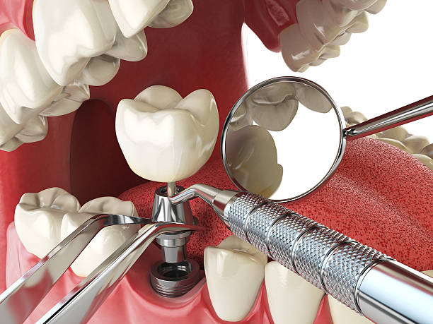 Best Emergency Treatment for Oral Infections in Westlake Corner, VA